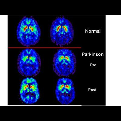 Sound Health Options - Ttmg  Sharry Edwards