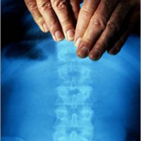 Podcast Episode #13: Nutrition, Lateral Strength Building  Chiropractic