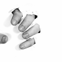 Reasons for Catching Nail Fungus