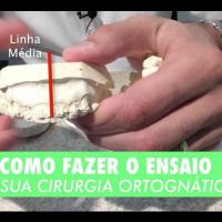 #20 Como Fazer O ENSAIO DE SUA CIRURGIA ORTOGNÀTICA