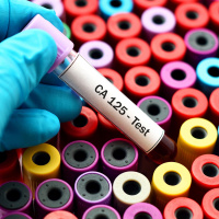 (44) Diagnóstico do cancro do ovário