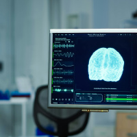 Como a neurociência explica nossas decisões: o papel da intuição no pensar e no agir