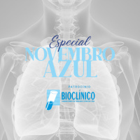 Câncer de Pulmão - Especial Novembro Azul