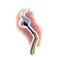 More than Job Demands or Personality Lack of Organizational Respect Fuels Employee Burnout