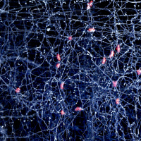 GSK and Alphabet team up to find biolectronic cures