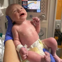 The Happy Pod: The baby saved by surgery in the womb