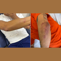 Ataques homofóbicos em SP ficam sem identificação de autores e vítimas relatam frustração