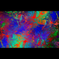 What is the Difference Between Hospice  Death Doula Services?