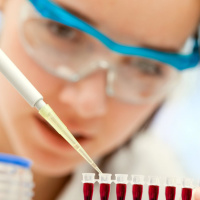 Can You Still Exercise When Recovering From Overtraining, What Is The Best Blood Test, And 3 Good Testosterone Supplements. 