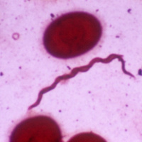 The Shocking Truth About The Global Epidemic Of Lyme Disease