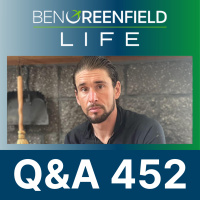 QA 452: Does NR or NAD Really Cause Cancer, The Latest On THC  Your Brain, Super-Ager Brains, Artery Unclogging  Much More.