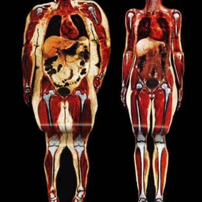 Ben Greenfield Fitness: Diet, Fat Loss And Performance