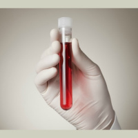 Popular Blood Tests—the Facts, Ranges, and Alternatives You Should Know