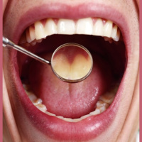 Oral Health: What You Eat (and Don’t Eat) Counts