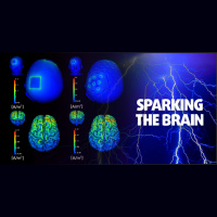 Sparking The Brain