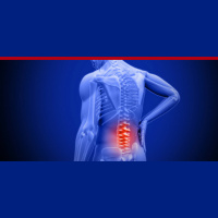 315: How To Fix Low Back Pain Naturally (Without Drugs or Surgery) with Dr. Chad Waterbury