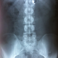 #228 Shootout Survivor Dan Smith