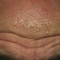 Schweiß - ein verkanntes Sekret