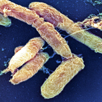 #01 Die Pest im Mittelalter - Europas größte demographische Katastrophe