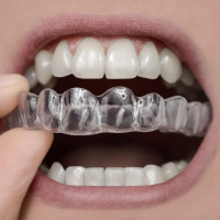 Weg mit der Beißschiene! – Wie geht nachhaltige Entspannung?