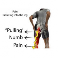 Sciatica - How does it feel? Step 1 in the Osteopathic evaluation of your individual case