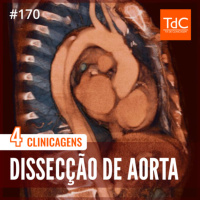 Episódio 170: Dissecção de Aorta - 4 Clinicagens