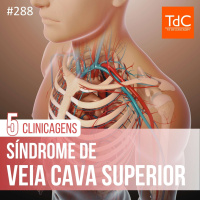 TdC 288: 5 Clinicagens de síndrome de veia cava superior