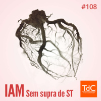 Episódio 108: Infarto Sem Supra de Segmento ST