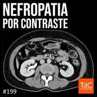 TdC 199: Nefropatia por Contraste