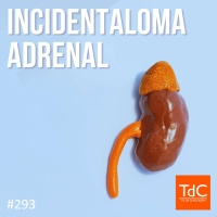 TdC 293: Abordagem de Incidentaloma adrenal 