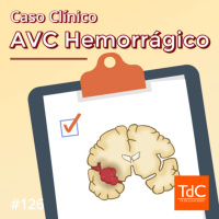 Episódio 126: Caso Clínico de AVC Hemorrágico