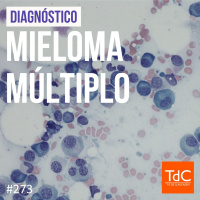 TdC 273: Diagnóstico de mieloma múltiplo