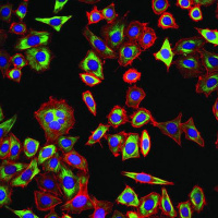 Famous Tumors