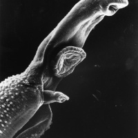 Parasites
