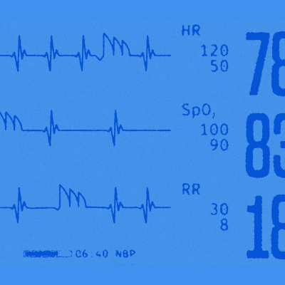 Radiolab