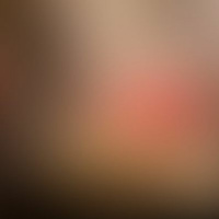 #578 - Teratoma Homunculus