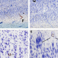 							 Interview with Kathy Rockland 							