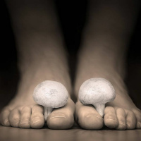 Evaluating Nail Fungus Treatment Options