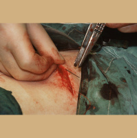 Hair Cells Could Heal Skin Sans Scars