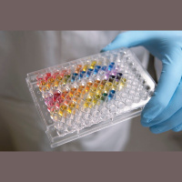 Computerized Chemical Toxicity Prediction Beats Animal Testing