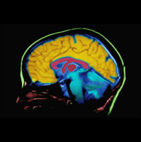 Techs Brain Effect: Its Complicated