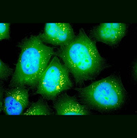 Inhaled RNA Might Help Heal Cystic Fibrosis