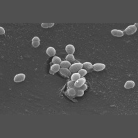 U.S. Immigrants Leave Countrymdashand MicrobesmdashBehind