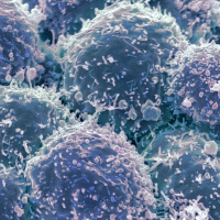 Transforming the Trajectory of Lung Cancer [Sponsored]