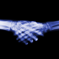 Math Cracks a Knuckle-Cracking Mystery