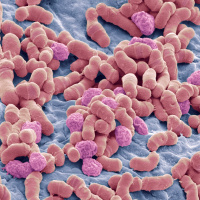 Rain Forest Dwellers and Urbanites Have Consistently Different Microbiomes