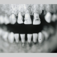 Ancient Tooth Tartar Traps Clues to Iron Age Diet