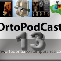 Episode 13 - Corticotomias alveolares na Ortodontia: indicações e efeitos na movimentação dentária