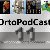 Episode 11 - Influência do Tipo de Fio Ortodôntico e da Angulação de Segunda Ordem sobre as Forças de Fricção