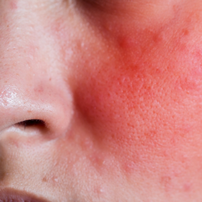 Medical Medium Podcast